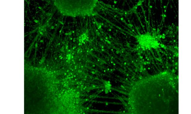 mini-brains stem cell research...
