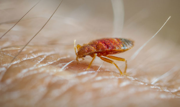 Bed bug feeding on human skin. (Photo by: Edwin Remsburg/VW Pics via Getty Images)...