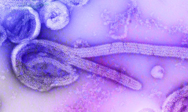 This is an electron microscopic image of the of Ebola virus. Five people have died of Ebola in a fr...