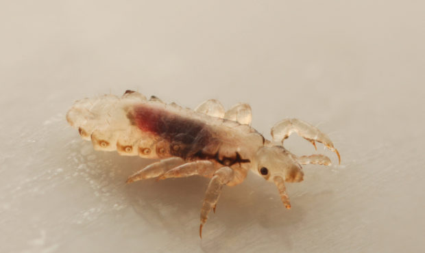 Live Mic: Lice infestations rising during pandemic...