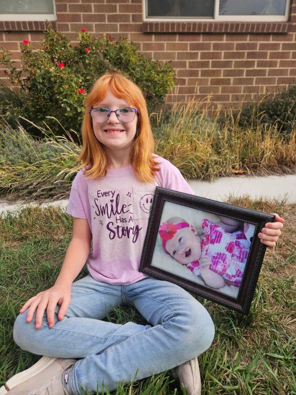 A Utah mother and daughter share their experiences living with cleft lip and palate, from surgeries and treatment to advocacy and support. (Tiffiny Tyler)