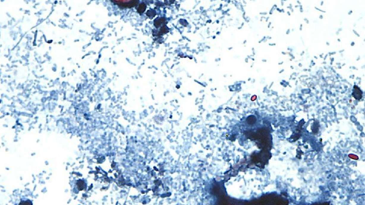 Two people in Michigan have died in connection with the outbreak of cyclosporiasis, health official...
